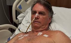 Ex-presidente Bolsonaro receberá alta na sexta, mas com restrições severas