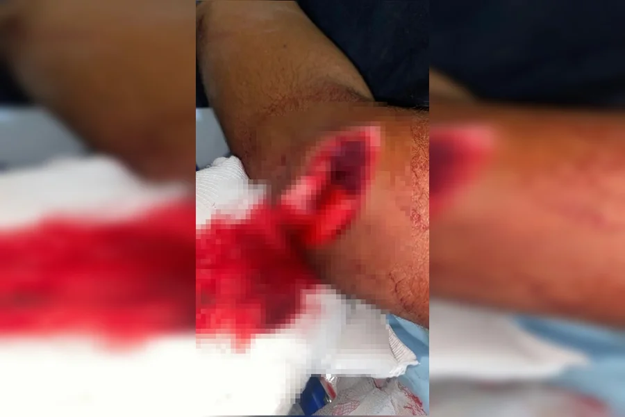 Homem que feriu rival com facão é preso em Formosa ao tentar embarcar para a Bahia