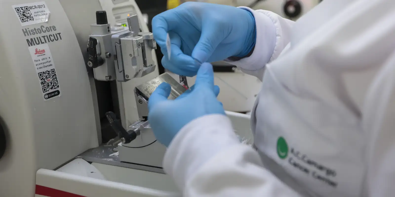 SUS incorpora tratamento combinado para leucemia mieloide aguda em adultos