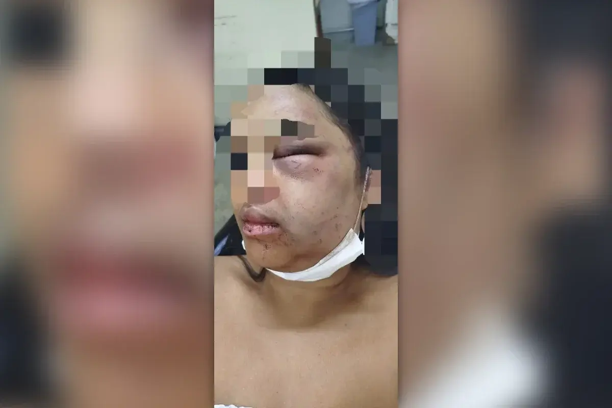 Homem é preso por violência contra a mulher após espancar e fraturar maxilar de ex em Planaltina