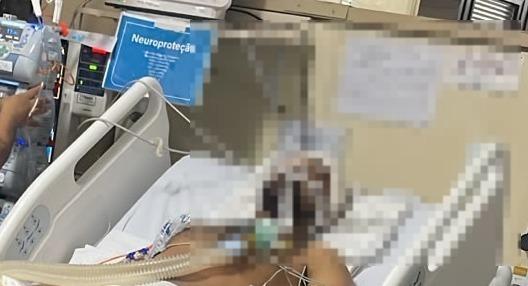 Zelador agredido na Asa Norte está intubado em estado grave no HBDF