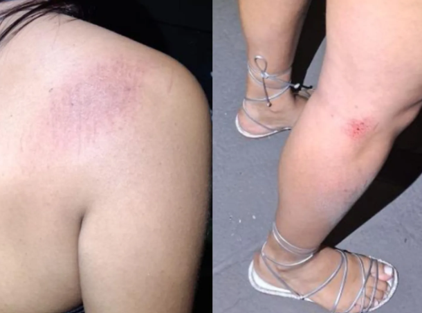 Jovem sofre agressão e atropelamento em Anápolis após briga de bar