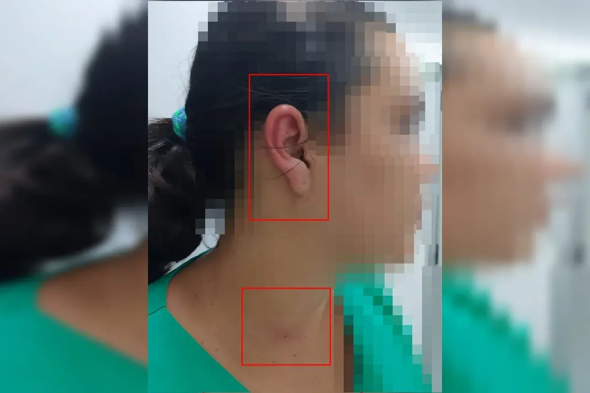 Técnica de enfermagem sofre agressão na UPA de Sobradinho durante atendimento