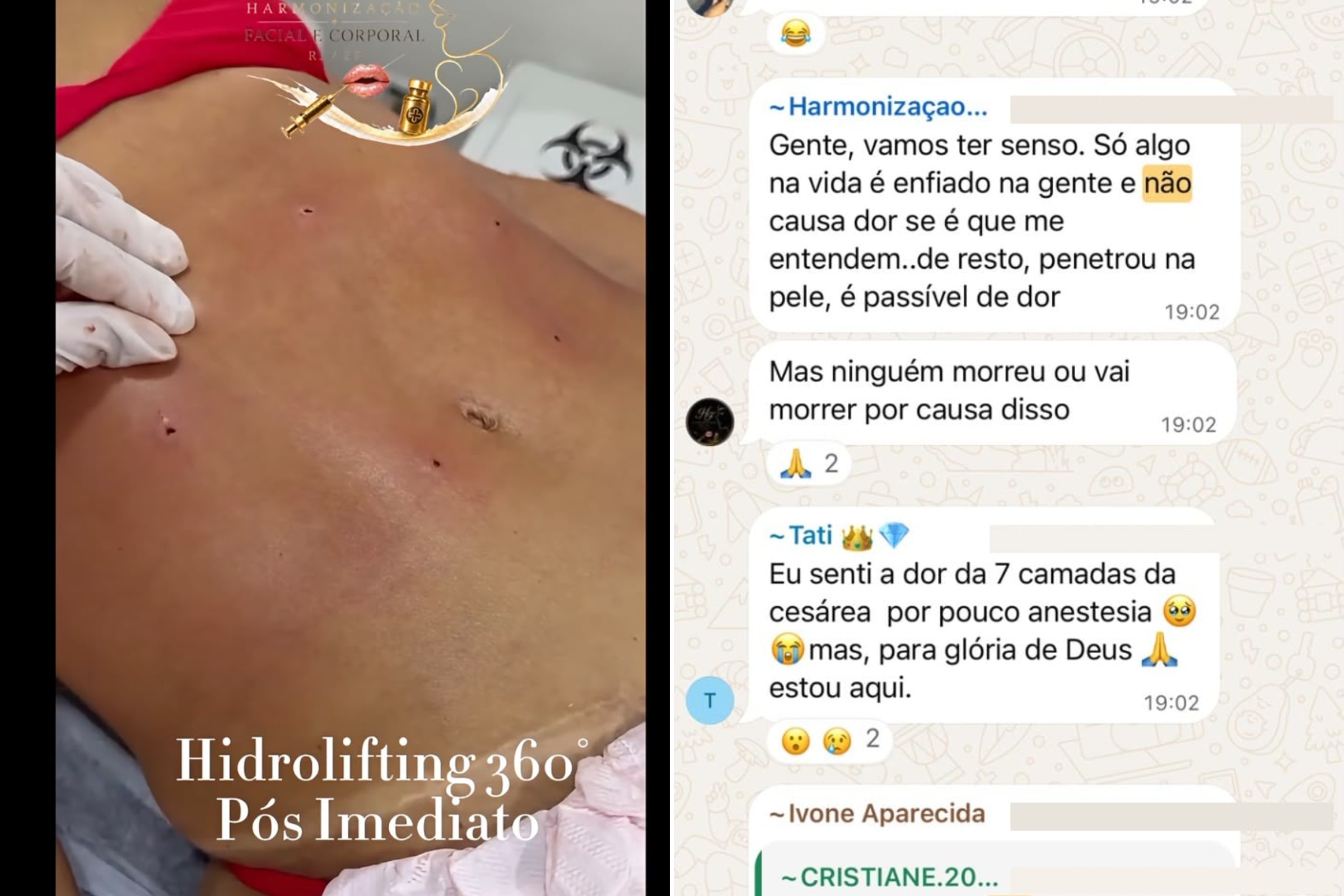Clínica no RJ é investigada após denúncias de lipo irregular