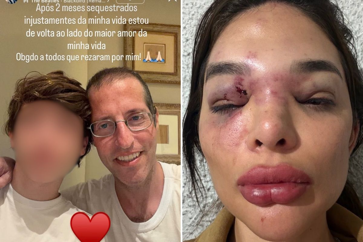 Ivo Kos usou arma de choque e taco para agredir esposa, aponta MPSP
