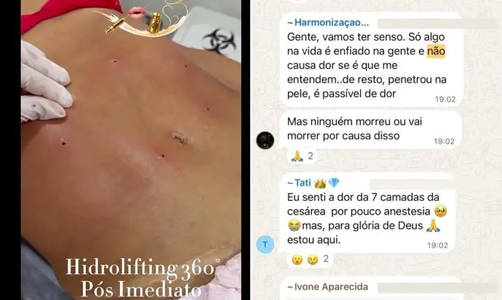Clínica no RJ é investigada após denúncias de lipo irregular