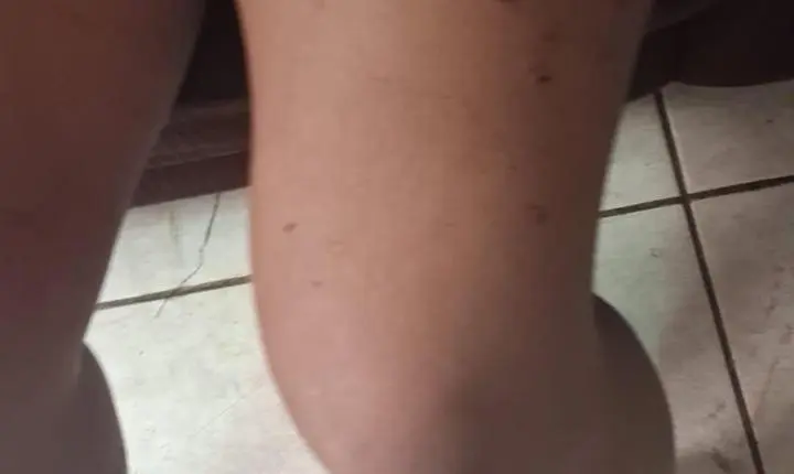 GCM de Luziânia age rápido e socorre vítima de tentativa de feminicídio