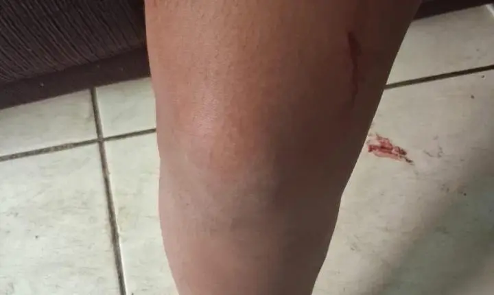 GCM de Luziânia age rápido e socorre vítima de tentativa de feminicídio