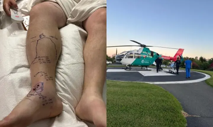 Homem sobrevive a picada de cascavel após receber 54 doses de soro antiofídico nos EUA