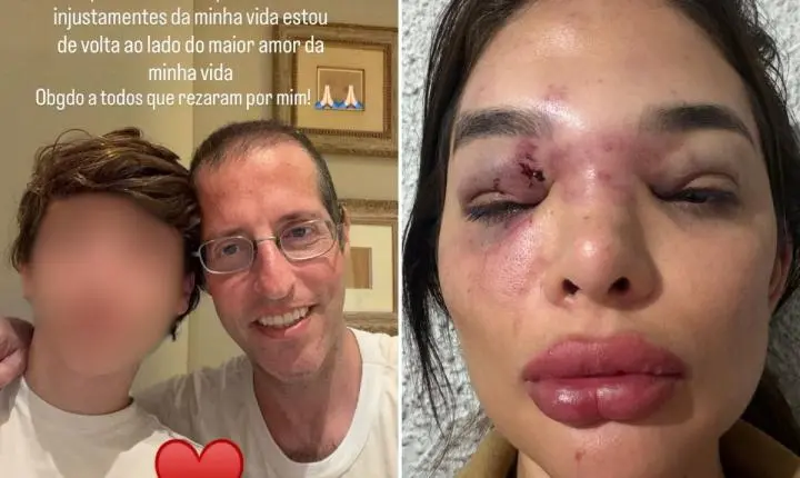 Ivo Kos usou arma de choque e taco para agredir esposa, aponta MPSP