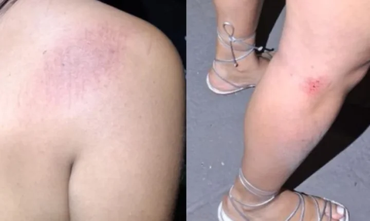 Jovem sofre agressão e atropelamento em Anápolis após briga de bar