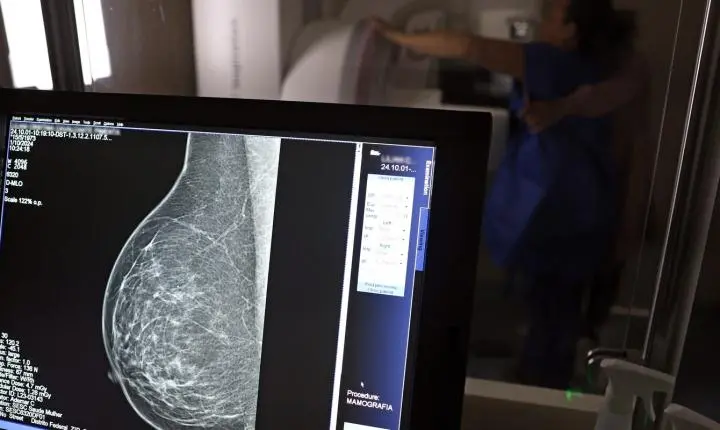 Médicos publicam guia prático para evitar recusa de mamografia digital