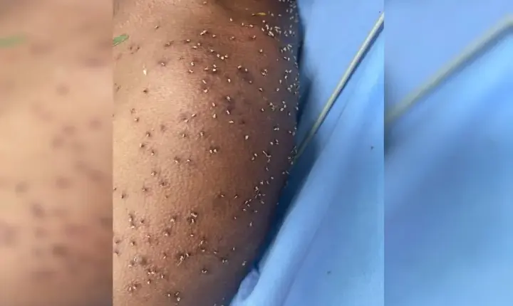 Ataque de abelhas deixa homem inconsciente e em estado grave em Goiás