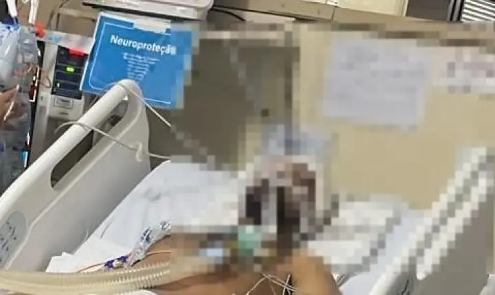 Zelador agredido na Asa Norte está intubado em estado grave no HBDF